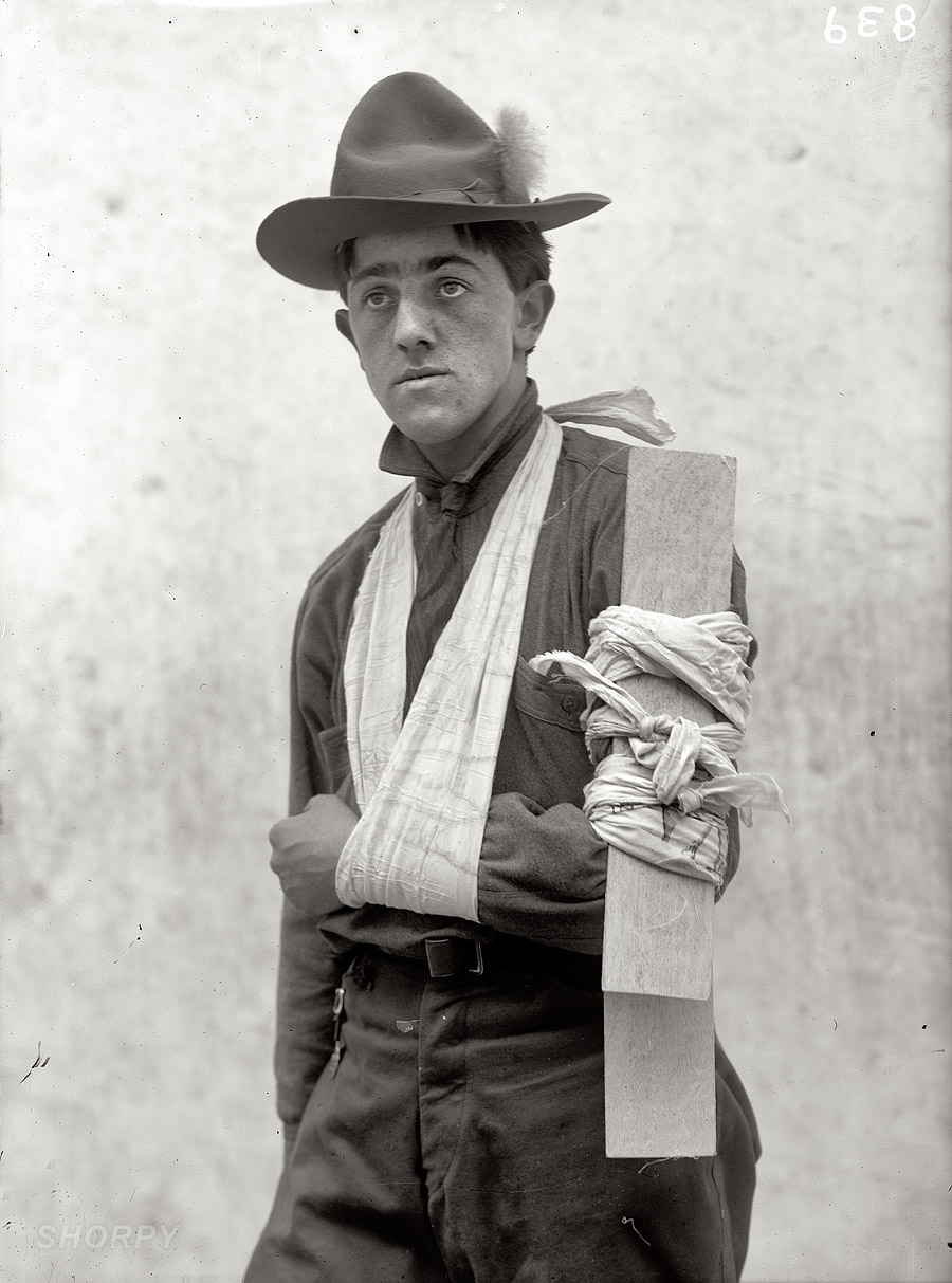"Boy Scout training demonstration, 1912." Fifth in our series of bandaged, splinted and faux-injured Scouts. Harris & Ewing glass negative. View full size.