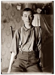 Harry McShane, 134 Broadway, Cincinnati. Sixteen years of age on June 29, 1908. Had his left arm pulled off near shoulder, and right leg broken through kneecap by being caught on belt of a machine in Spring Works factory [below] in May 1908. Had been working there more than 2 years. Was on his feet for first time after the accident the day this photo was taken. No attention was paid by employers to the boy either at hospital or home according to statement of boy's father. No compensation. View full size. Photograph and caption by Lewis Wickes Hine.