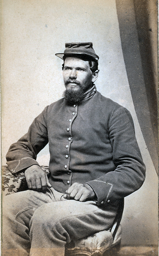 CDV of a gritty looking Union soldier.  Looks to be an artillery man.  Notice his rough looking hands.  Taken in Boston by Hussey on 556 Washington Street.
